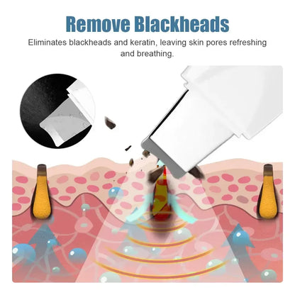 Deep Vibrate Skin Scrubber Facial Cleaner