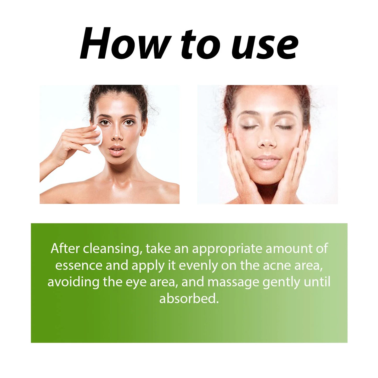 Acne Face Cream Pimple Treatment Oil Control Repair