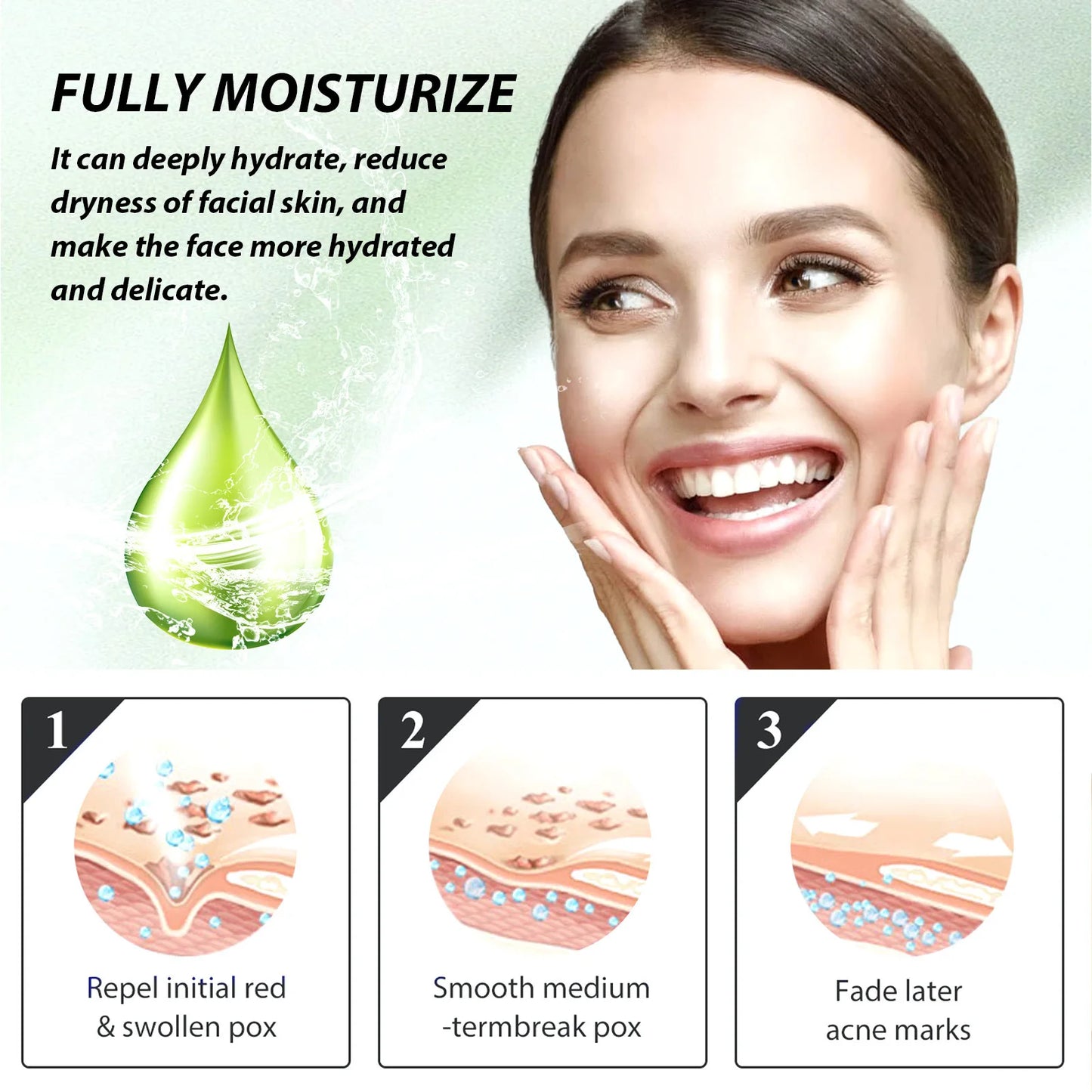 Acne Face Cream Pimple Treatment Oil Control Repair