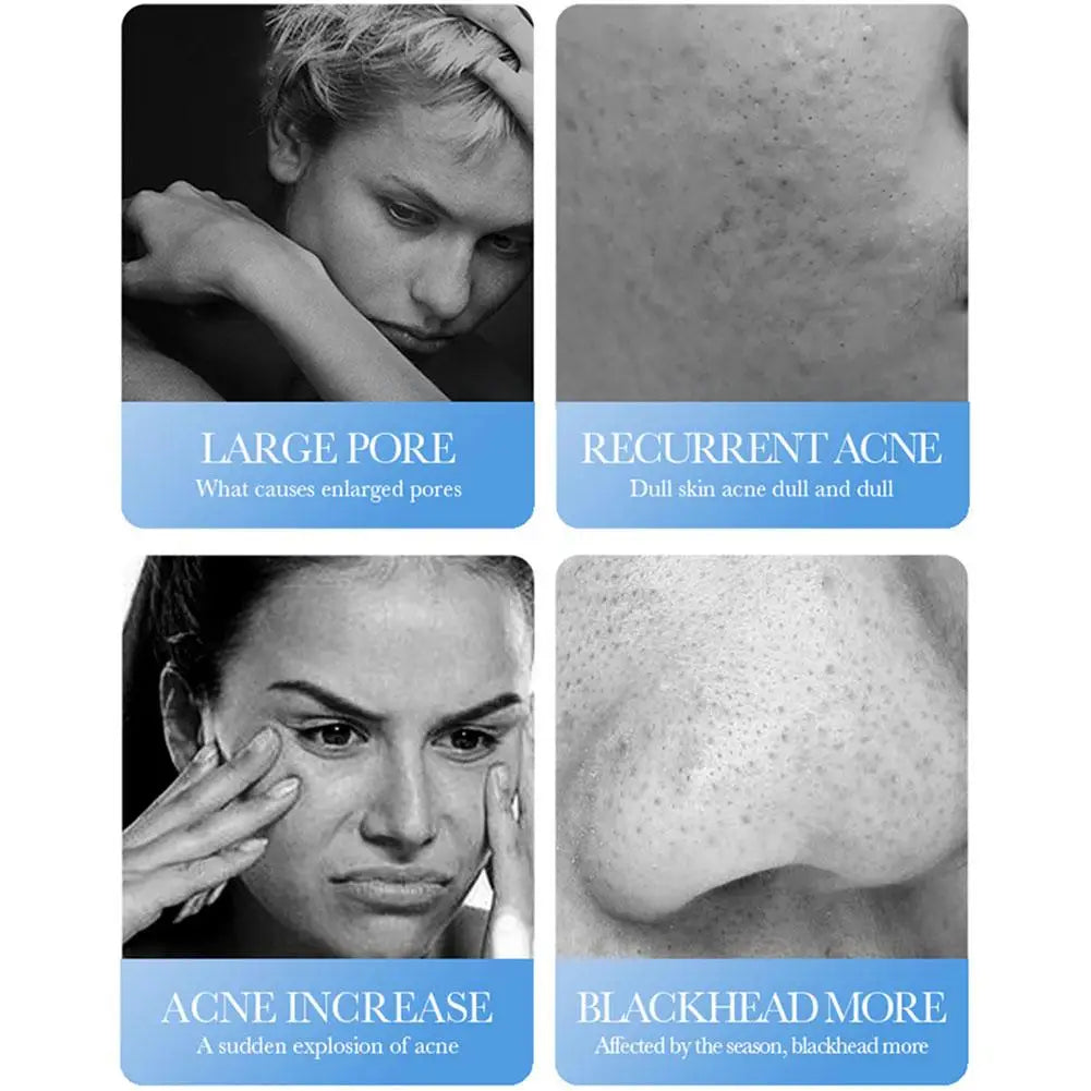 BIOAQUA Salicylic Acid Face Cream