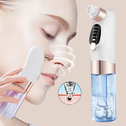 USB portable blackhead cleaner